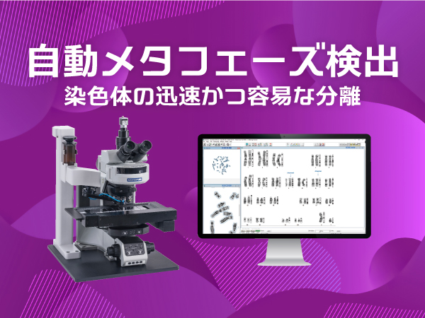 高解像度画像取得 スタート＆ウォークアウェイ 正確な核型分析のための強力なアルゴリズム 染色体の迅速かつ容易な分離 高度なレポート作成ツール リモートアクセス