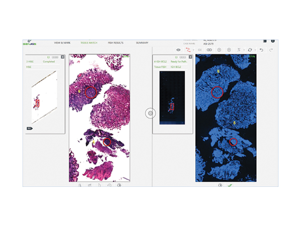 PathFusion ソフトウェア画面3