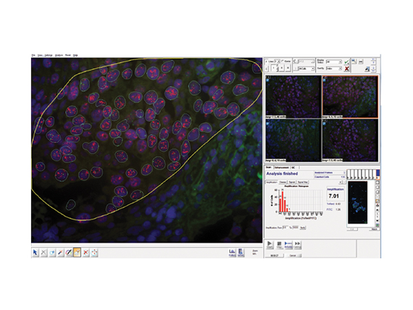 PathFusion ソフトウェア画面4