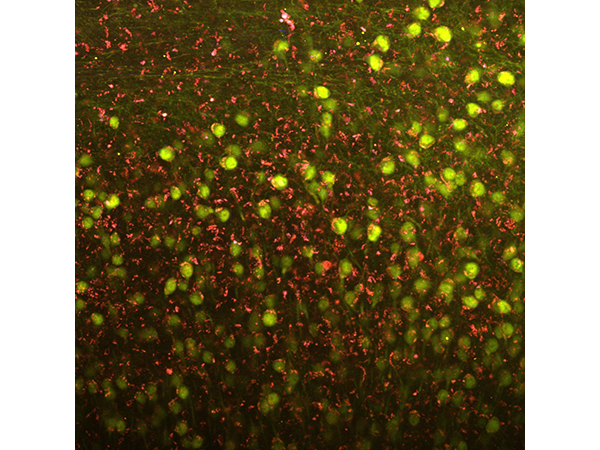 ネズミの神経細胞の画像