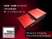 超音波・光音響イメージング用計測ユニット MoleculUS 超音波・光音響イメージング用計測ユニット MoleculUS