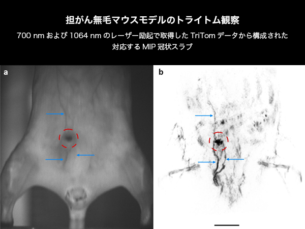 担がん無毛マウスモデルのトライトム観察