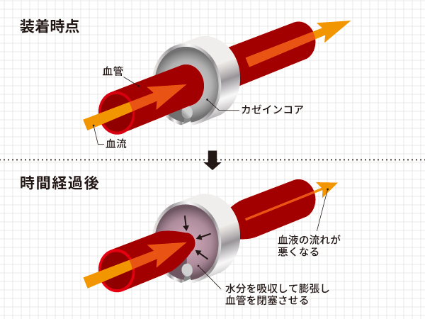 アメロイドコンストリクター　構成図