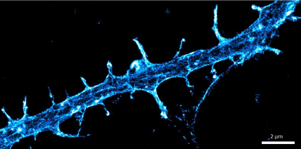 樹状突起スパインにおけるアクチン細胞骨格の解説