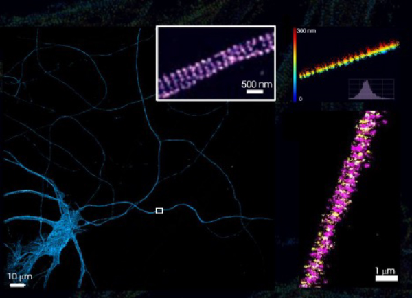 海馬初代培養における神経ネットワークの細胞骨格周期の解明
