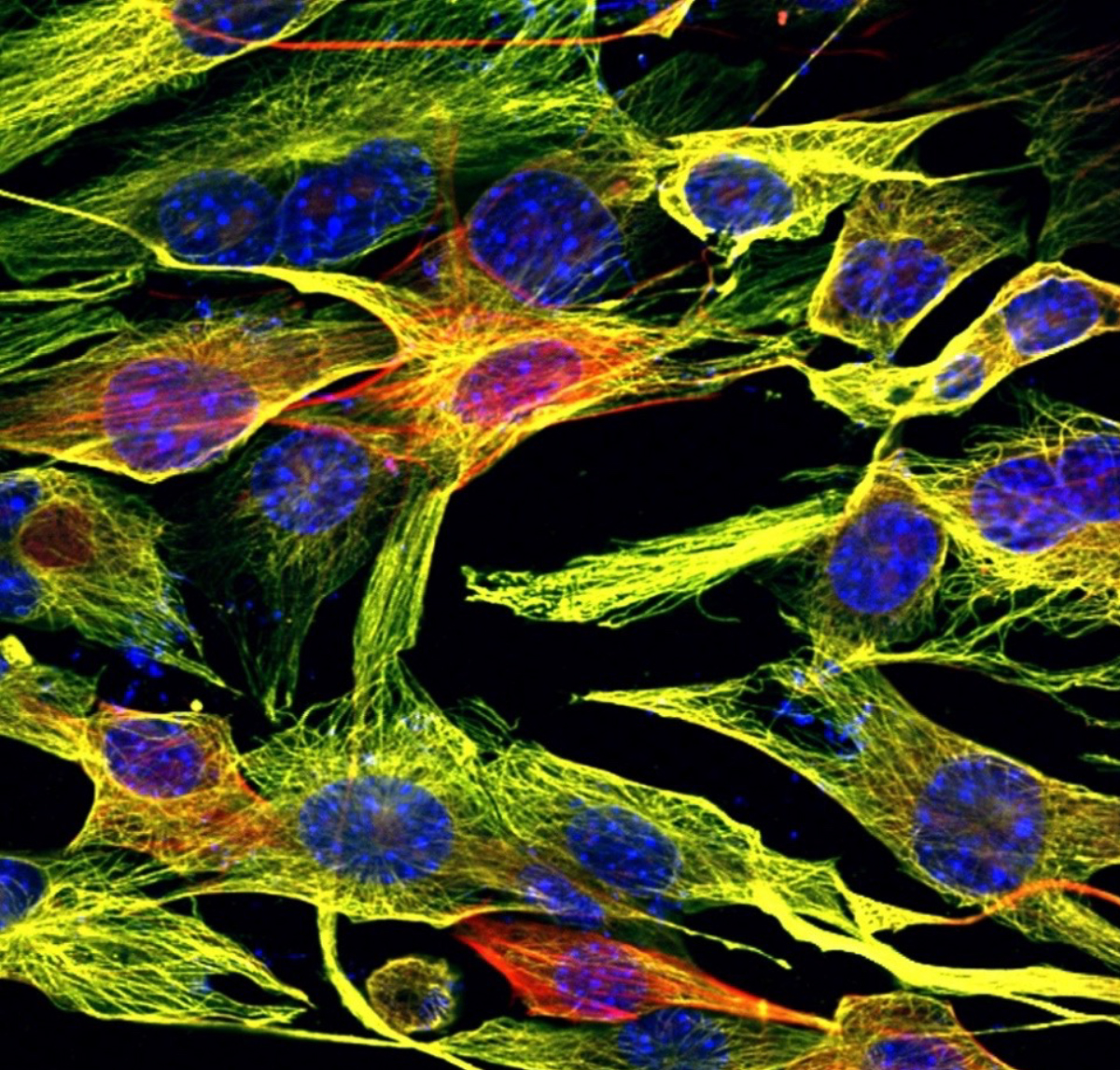 マウス線維芽細胞